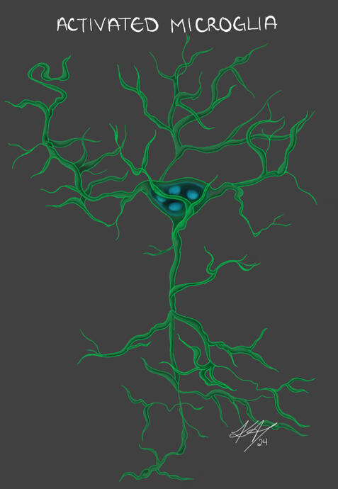 Activated Microglia